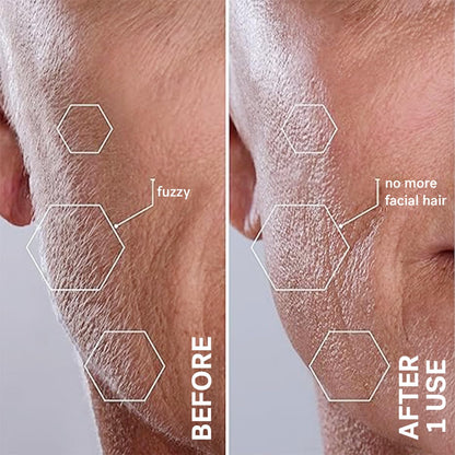 Michael Todd Beauty Sonicsmooth Dermaplane - Maquinilla de afeitar...