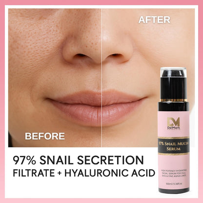Suero de mucina de caracol de 3.4 fl oz, 97% filtrado de secreción de caracol con ácido hialurónico, esencia reparadora de energía, removedor de manchas oscuras, cuidado de la piel coreano, suero hidratante para cara, ojos y cuello