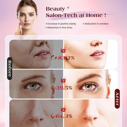 INTEO Dispositivo facial de microcorriente, 3 modos de terapia de l...