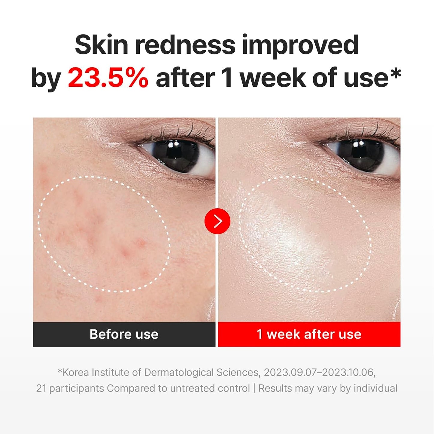 CENTELLIAN 24 Madeca Cream Time Reverse &amp; Active Renew PDRN Duo...