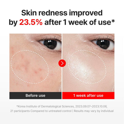 CENTELLIAN 24 Madeca Cream Time Reverse &amp; Active Renew PDRN Duo...