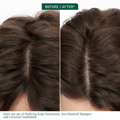 Biolage Scalp Sync - Concentrado purificador - Tratamiento exfoliante y aclarador del cuero cabelludo seco, refrescante y revitalizante, mezcla de té fermentado y ácido glicólico