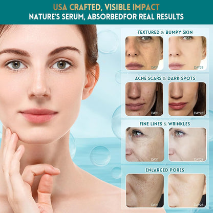 Suero Facial de Mucina de Caracol con Ácido Hialurónico – Suero Facial Antienvejecimiento para Líneas Finas, Arrugas y Piel Opaca – Esencia Hidratante y Reafirmante para Todos los Tipos de Piel