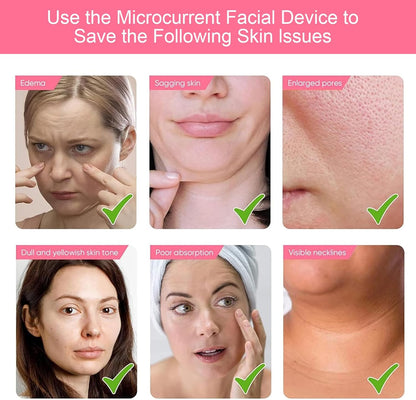Dispositivo facial de microcorriente, masajeador facial eléctrico,...