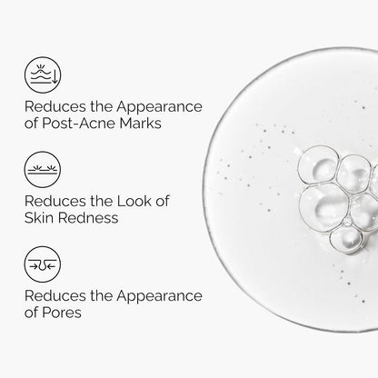 The Ordinary Solución de aloe 2% + NAG 2%, alivia la piel y se dirige a las marcas posteriores al acné, 1 onza líquida