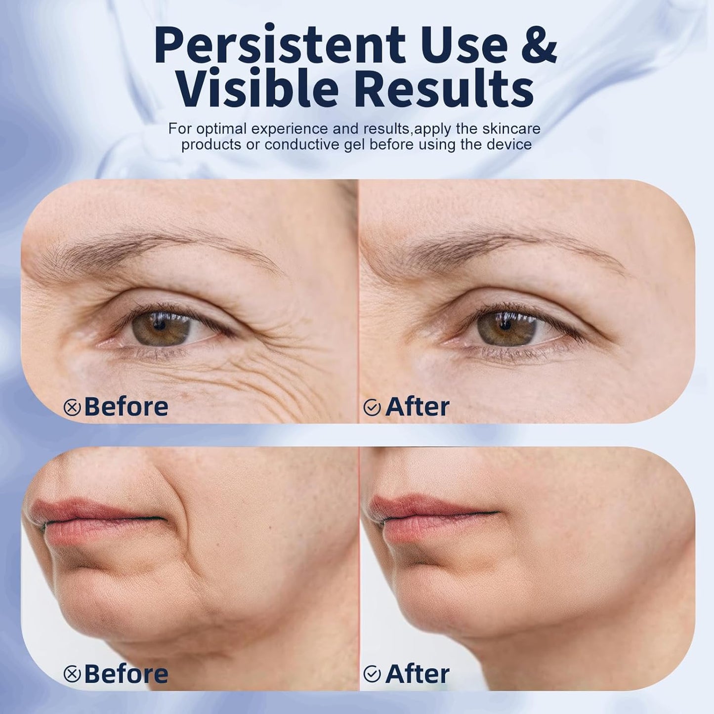Terapia de luz roja para cara, masajeador facial multifuncional con...