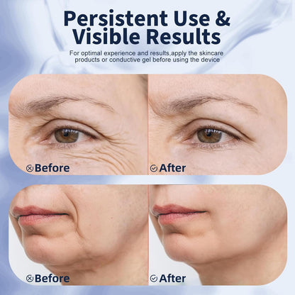Terapia de luz roja para cara, masajeador facial multifuncional con...