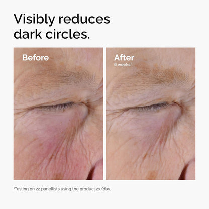The Ordinary Caffeine Solution 5% + EGCG, Depuffing Eye Serum for D...