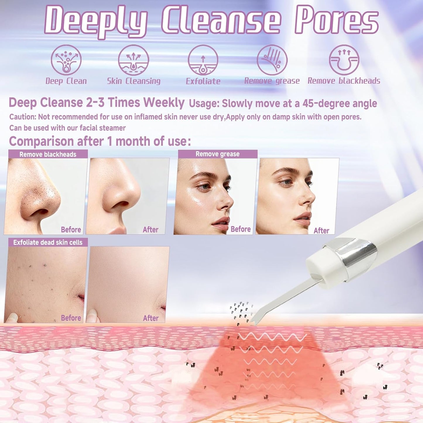 Lixeszt Espátula facial multifuncional limpiador de poros herramien...
