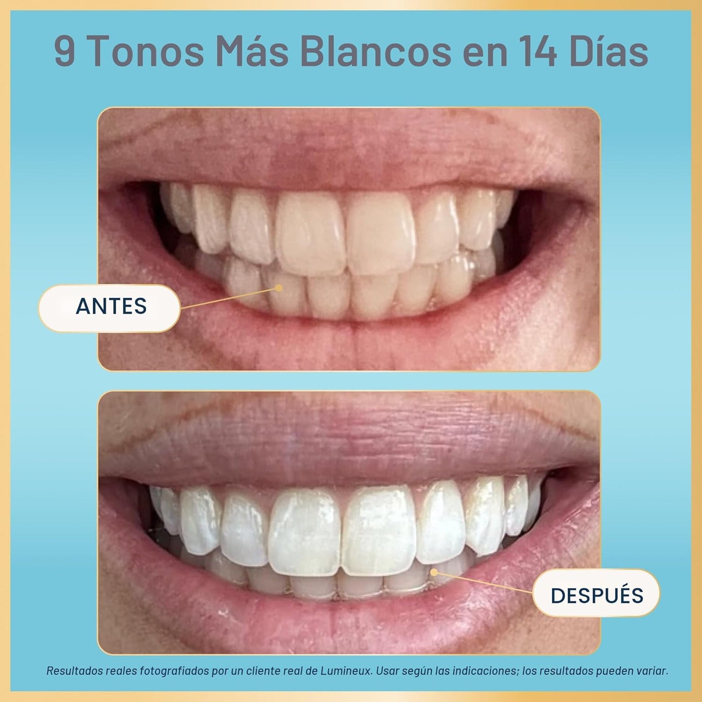 Lumineux Tiras blanqueadoras dentales - 21 tratamientos (3 meses) -...
