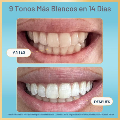 Lumineux Tiras blanqueadoras dentales - 21 tratamientos (3 meses) -...