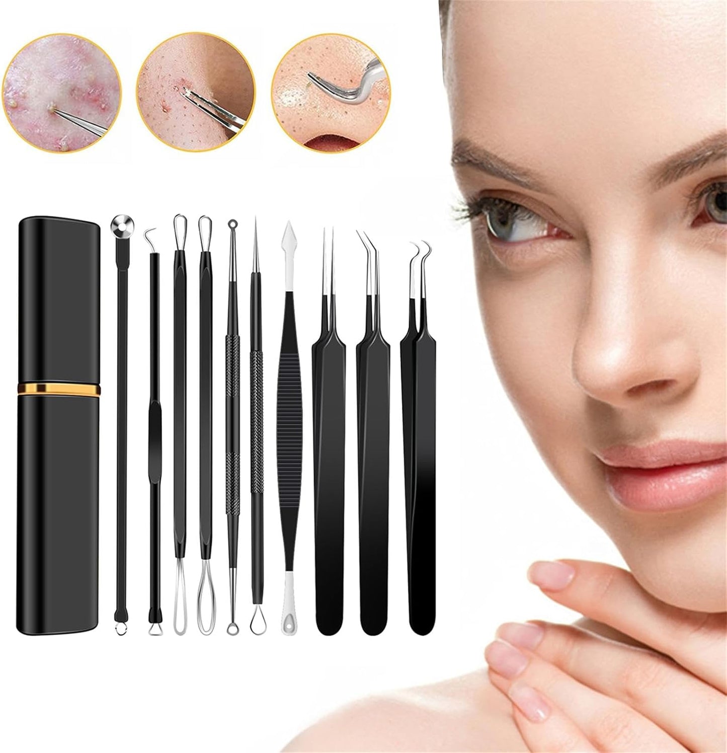 Kit de herramientas de acero inoxidable para eliminar puntos negros...