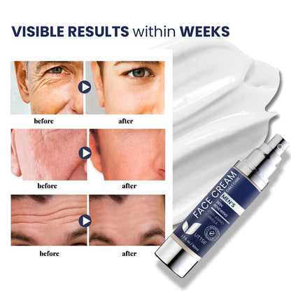 Crema facial 6 en 1 para hombres: crema antienvejecimiento y arrugas para hombres con colágeno, ácido hialurónico, vitaminas E y B, manteca de karité, removedor de manchas oscuras y tratamiento de bolsas para los ojos, 1.7 oz.