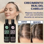 Moerie Champú y acondicionador para el crecimiento del cabello para...