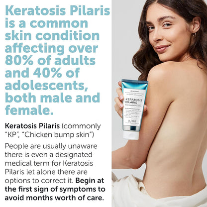 Tratamiento de queratosis pilaris | Loción de queratosis pilaris co...