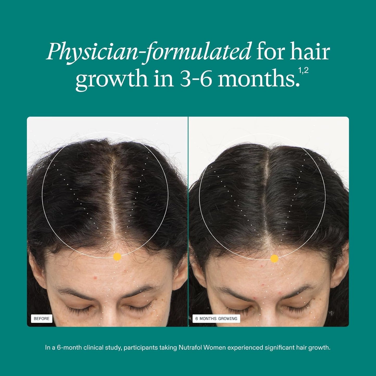 Nutrafol - Suplementos de crecimiento del cabello para mujeres, edades 18-44, clínicamente probados para cabello visiblemente más grueso y fuerte, recomendado por dermatólogos - suministro para 1 mes