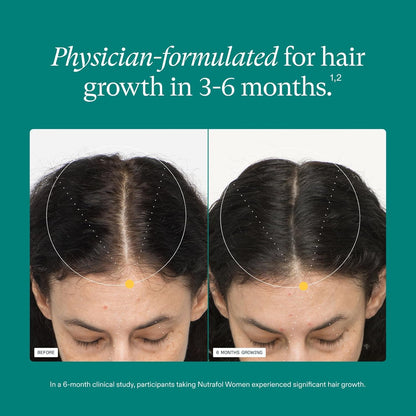 Nutrafol - Suplementos de crecimiento del cabello para mujeres, edades 18-44, clínicamente probados para cabello visiblemente más grueso y fuerte, recomendado por dermatólogos - suministro para 1 mes