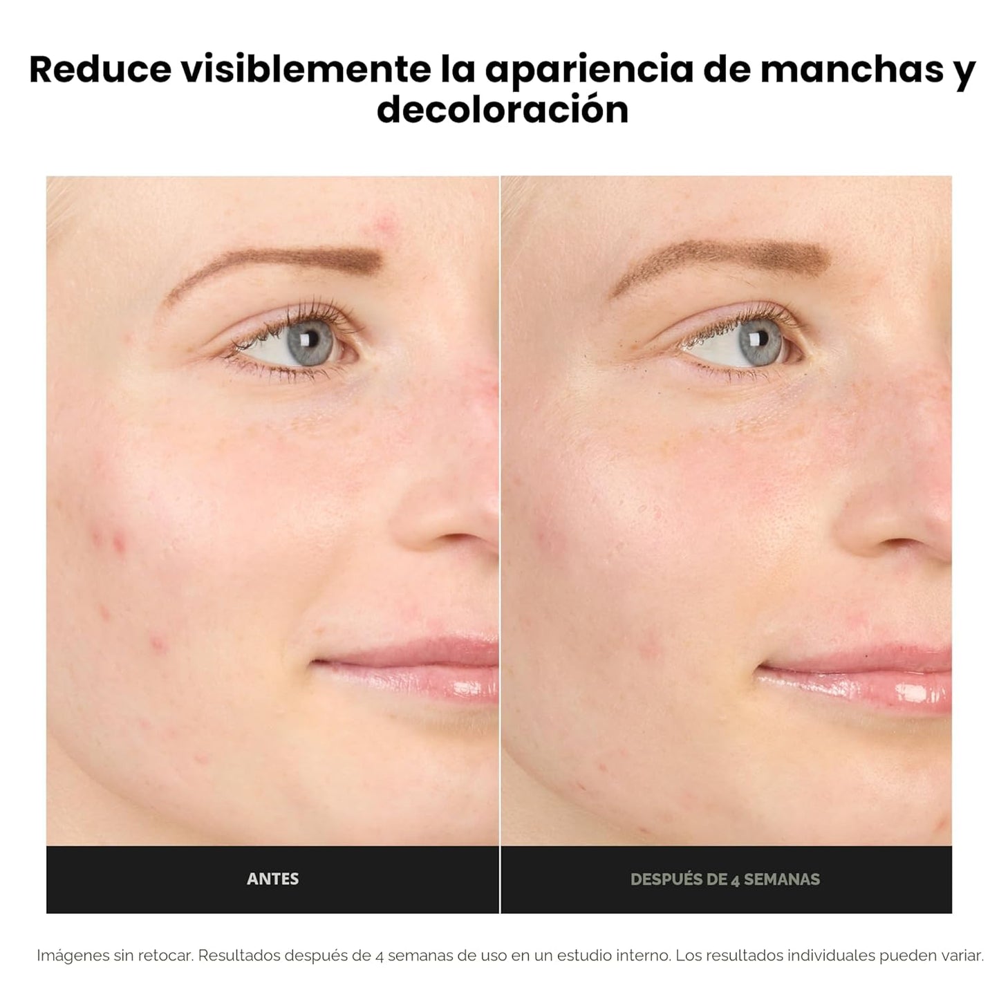 Paula's Choice BOOST Crema Gel Potenciadora de Ácido Azelaico a...