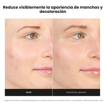 Paula's Choice BOOST Crema Gel Potenciadora de Ácido Azelaico a...