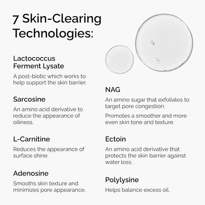 The Ordinary Suero equilibrante y clarificante, solución multiactiva para control de aceite y refinamiento de poros, 1 onza líquida