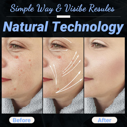 UUPAS - Varita facial de alta frecuencia, portátil de mano 4 en 1,...