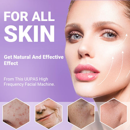 Varita Facial de Alta Frecuencia-UUPAS Máquina Facial Portátil de M...