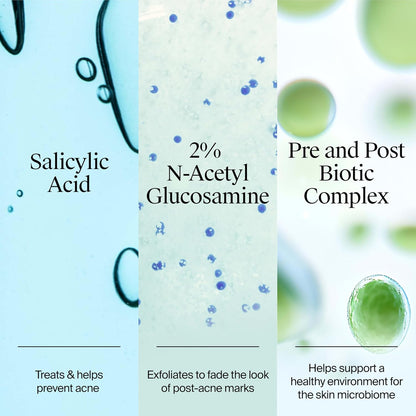 Neutrogena Hidratante de gel para acné uniformemente transparente con ácido salicílico y N-acetil glucosamina, hidratante facial ligero y no grasoso que ayuda a tratar brotes y desvanecer visiblemente