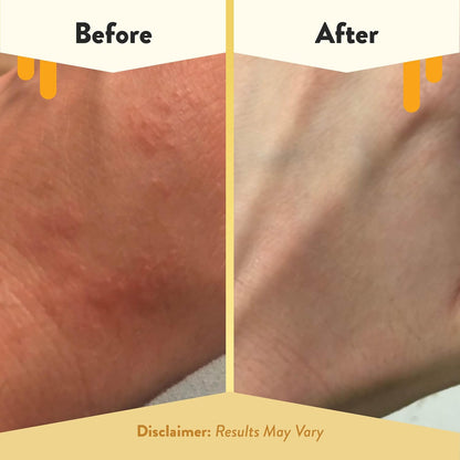 ECZEMA HONEY Loción corporal de avena - Crema de manos y cuerpo par...