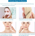 5 piezas de removedor de puntos negros, extractor de comedones, kit de pinzas curvas para puntos negros, kit de herramientas profesionales de acero inoxidable para eliminar espinillas, acné y manchas