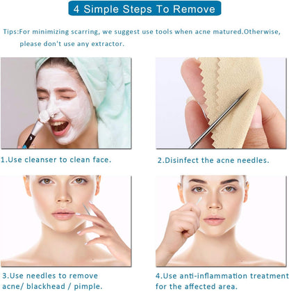 5 piezas de removedor de puntos negros, extractor de comedones, kit de pinzas curvas para puntos negros, kit de herramientas profesionales de acero inoxidable para eliminar espinillas, acné y manchas