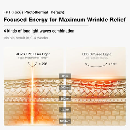 JOVS Máscara de terapia de luz láser para cara (blanco)