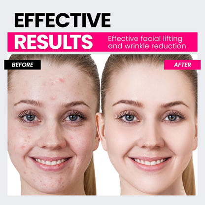 Hunvva Dispositivo facial de microcorriente, última tecnología de l...