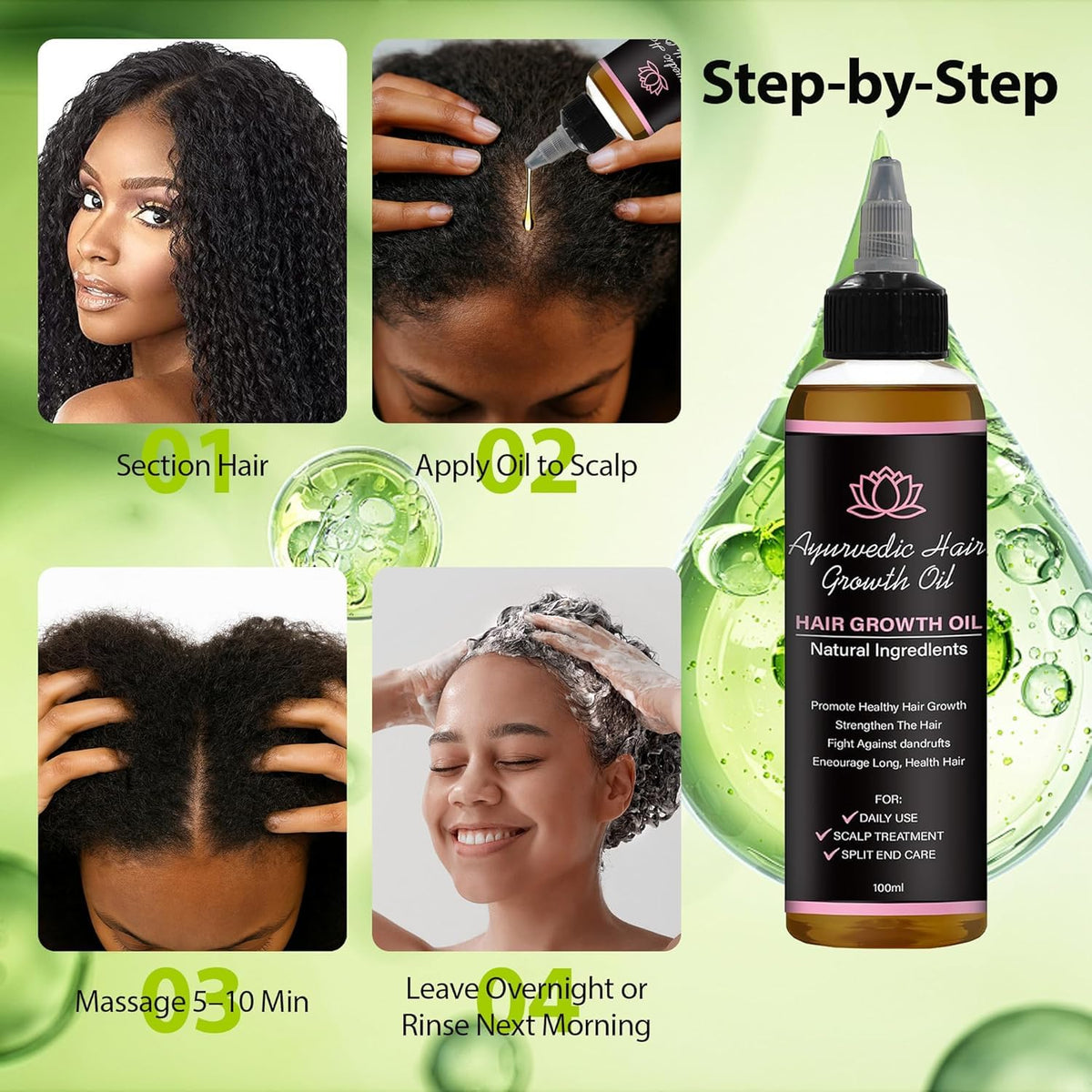 LIFEWITQUEENP Aceite de crecimiento para el cuidado del cabello, ac...