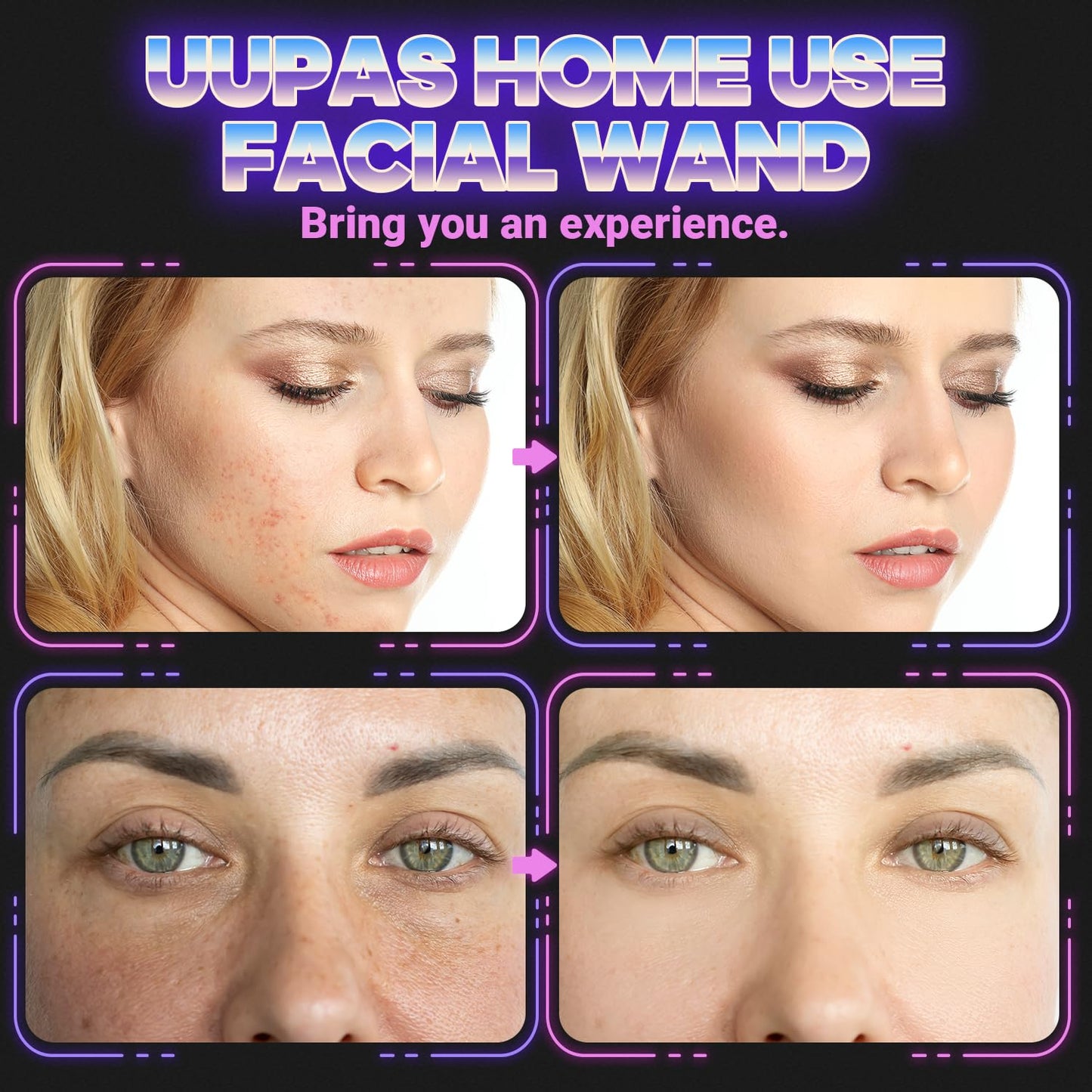 UUPAS Máquina facial de alta frecuencia de la varita de la cara de...