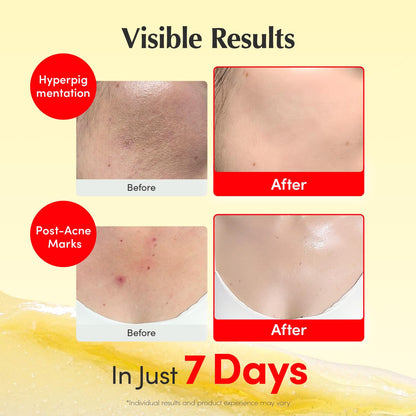 EQQUALBERRY Crema iluminadora de vitaminas, paquete de 2 \u2013 Vit...