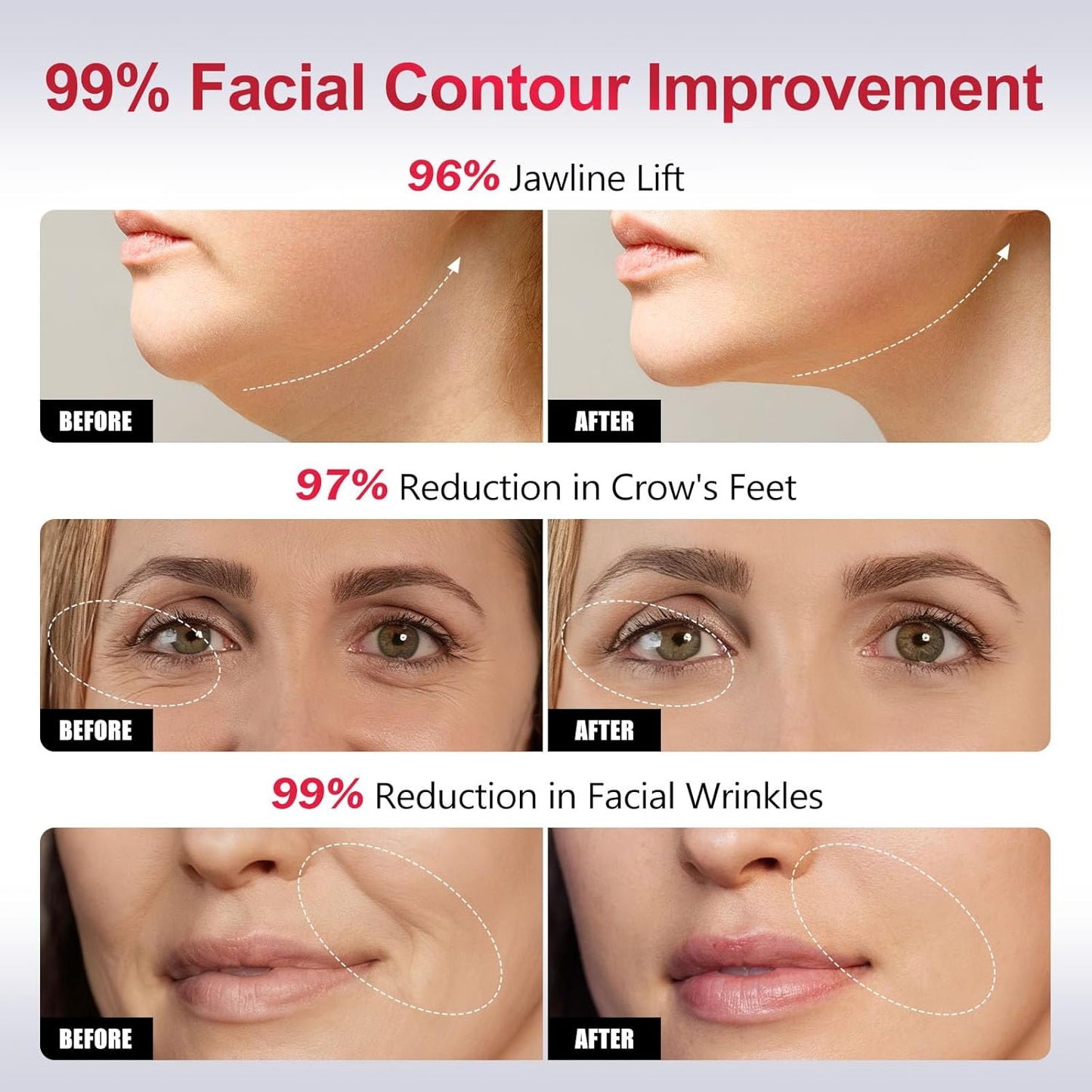 Dispositivo facial de microcorriente de luz roja 2 en 1 | Mejora la...