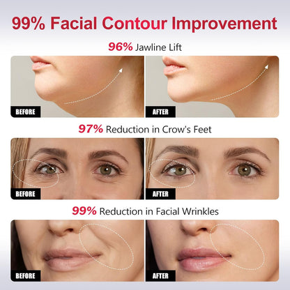 Dispositivo facial de microcorriente de luz roja 2 en 1 | Mejora la...
