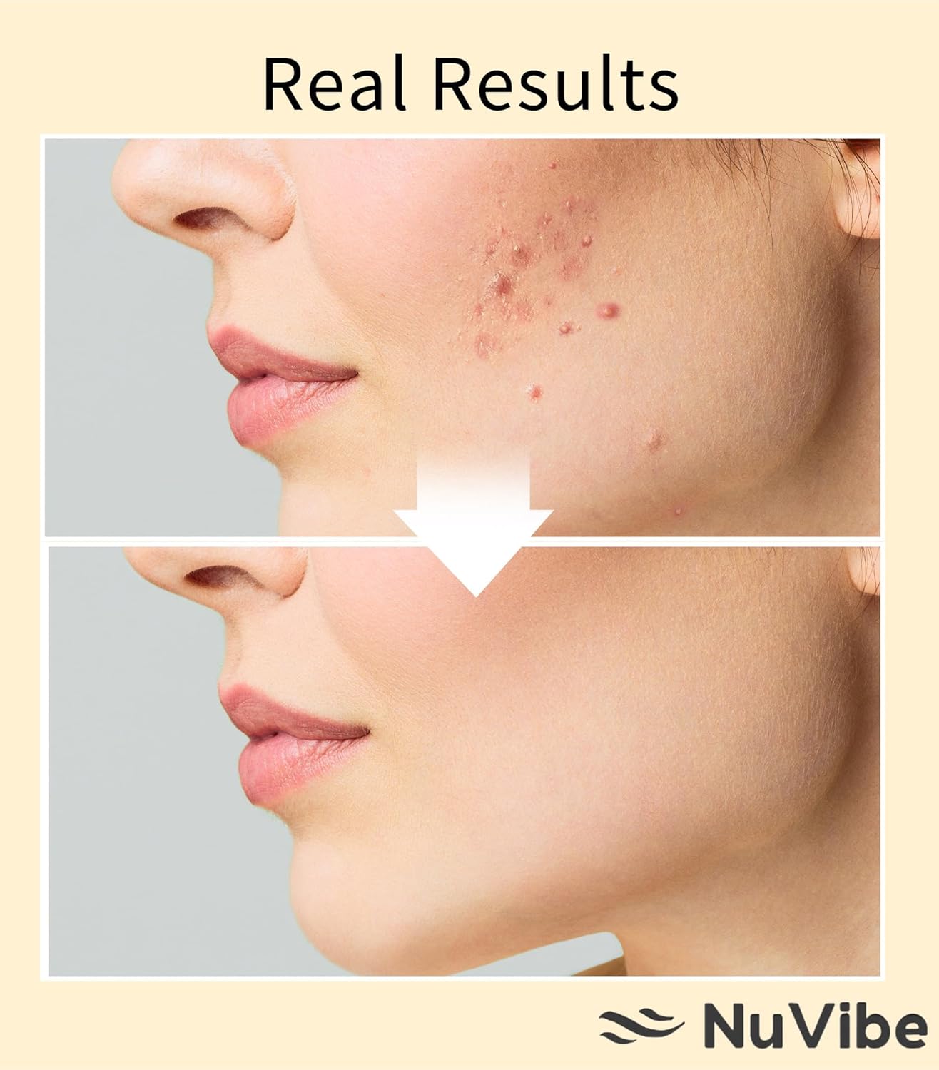 NuVibe Avanced Snail Mucin 96% Essence - Suero facial hidratante con filtrado de secreción de caracol para piel seca y opaca y líneas finas | Cuidado coreano de la piel para cara, ojos y cuello | 3.38 onzas líquidas (3.4 fl oz)