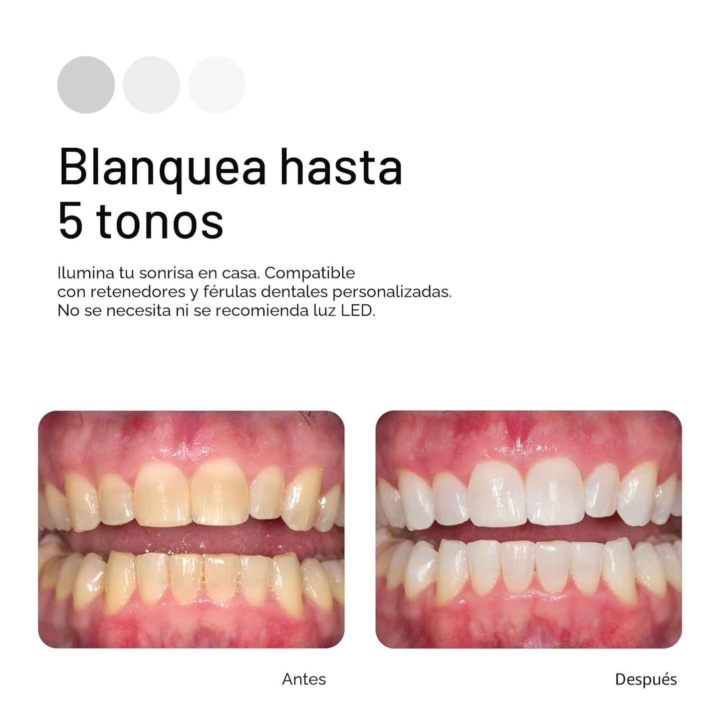 Opalescence 35% CP Mint - Jeringas de gel para blanquear los dientes - Kit de recarga (4 jeringas en total) Gel de peróxido de carbamida. Fabricado por Ultradent. Jeringas de repuesto para