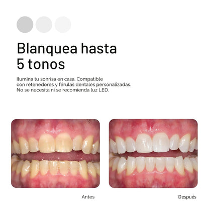Opalescence 35% CP Mint - Jeringas de gel para blanquear los dientes - Kit de recarga (4 jeringas en total) Gel de peróxido de carbamida. Fabricado por Ultradent. Jeringas de repuesto para