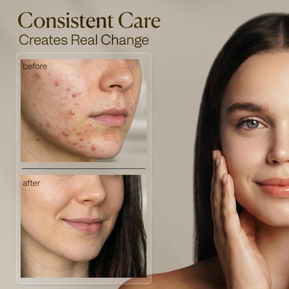 VogueNow Kit de vapor facial con 15 herramientas de cuidado de la p...