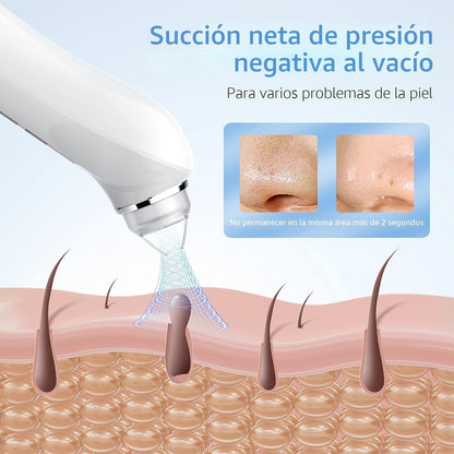 Aspiradora Removedora de Puntos Negros, Aspiradora de Poros con Int...