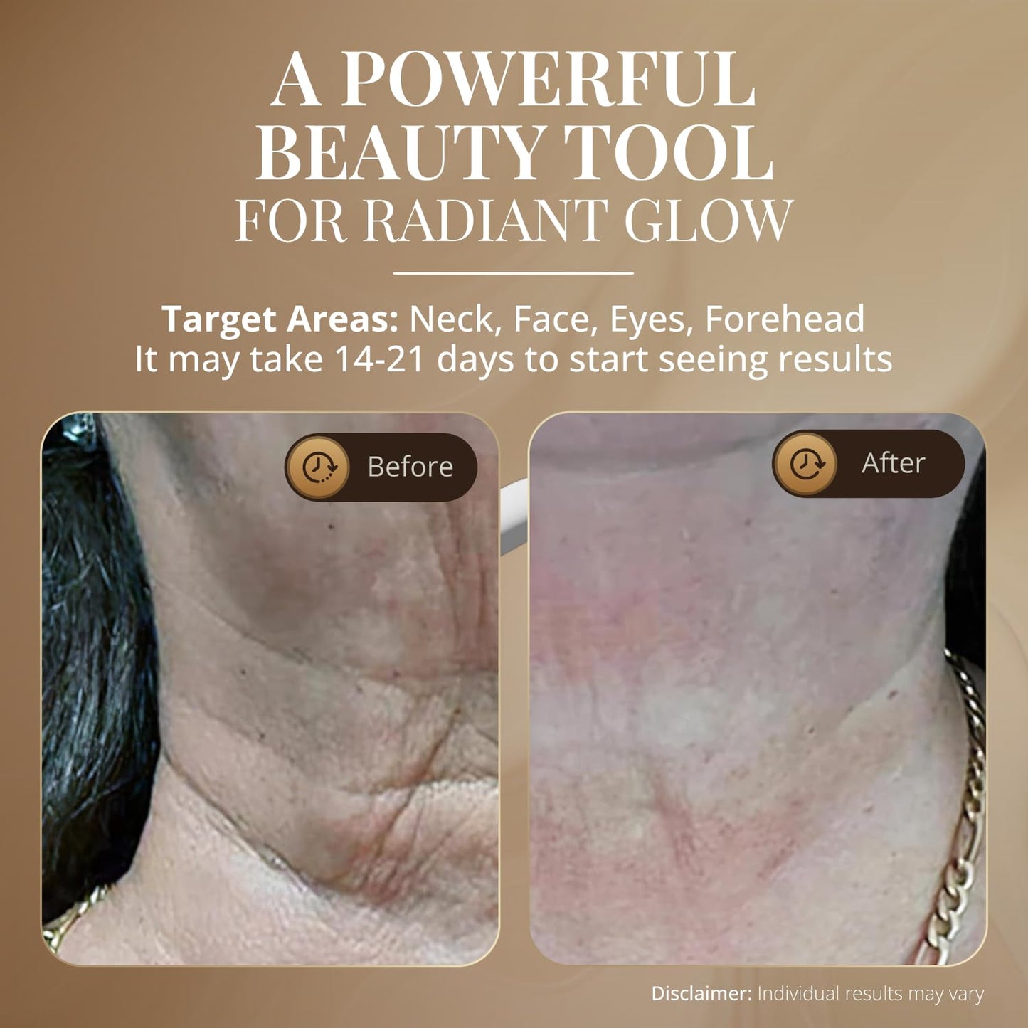 GLO24K - Dispositivo de belleza de luz roja para cara y cuello, her...