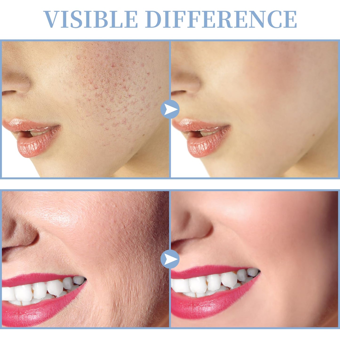Máquina Facial de Alta Frecuencia - TUMAKOU Máquina Portátil de Man...