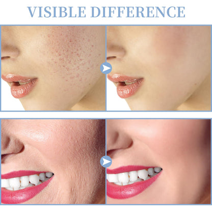 Máquina Facial de Alta Frecuencia - TUMAKOU Máquina Portátil de Man...