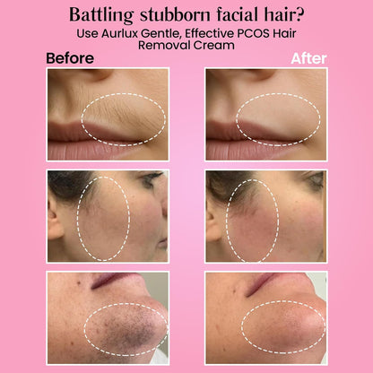 Aurlux Crema de depilación instantánea para mujeres, removedor de v...