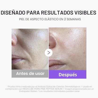 medicube Booster Pro Mini Plus | Dispositivo facial para luminosida...