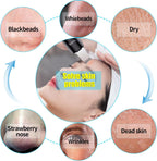 Limpiador facial de piel con pulverizador, pulverizador mejorado, e...