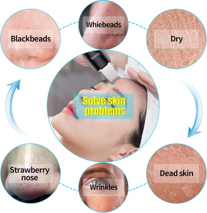 Limpiador facial de piel con pulverizador, pulverizador mejorado, e...