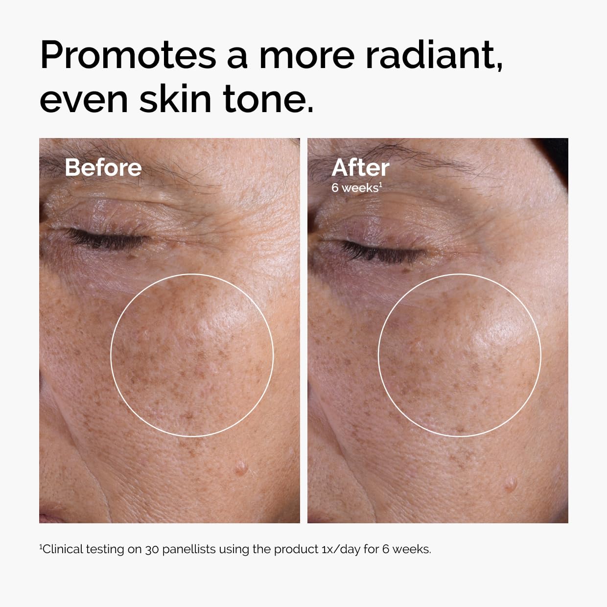 The Ordinary Glycolic Acid 7% Exfoliating Toner, Brightening and Sm...